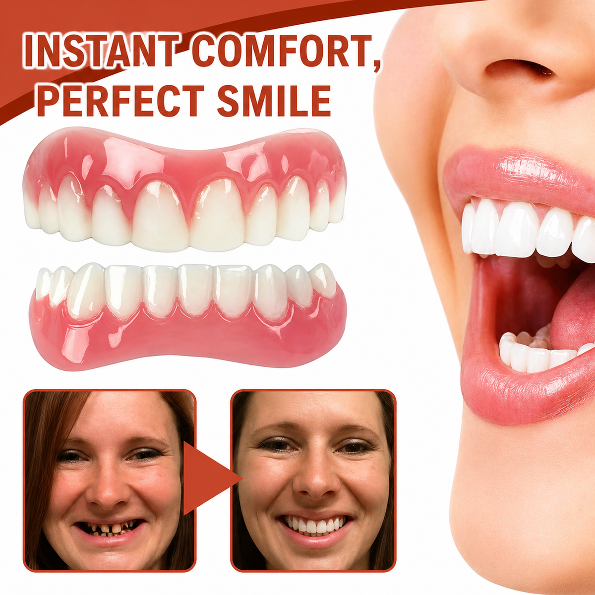 Upper and lower cosmetic dental veneer pieces with white teeth and pink gum-effect bases